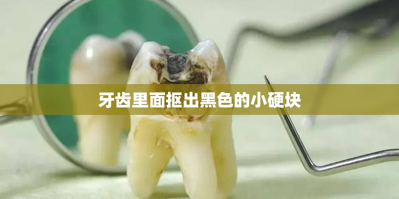 牙齿里面抠出黑色的小硬块