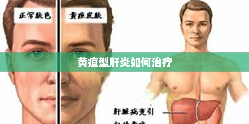 黄疸型肝炎如何治疗