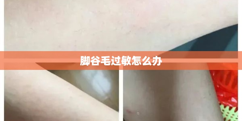 脚谷毛过敏怎么办