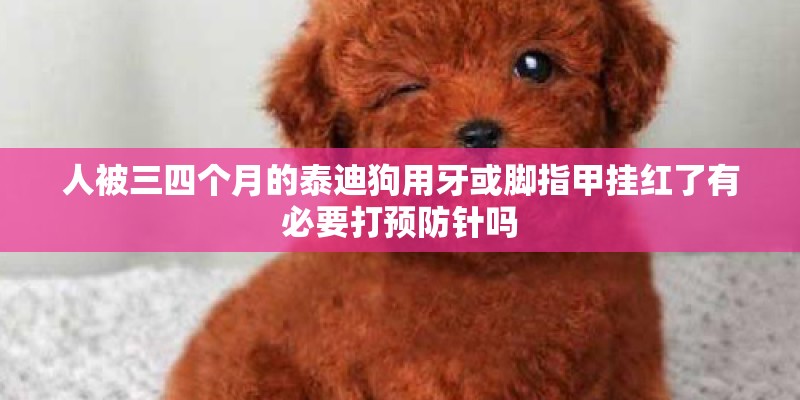 人被三四个月的泰迪狗用牙或脚指甲挂红了有必要打预防针吗 人被三四个月的泰迪狗用牙或脚指甲挂红了有必要打预防针吗