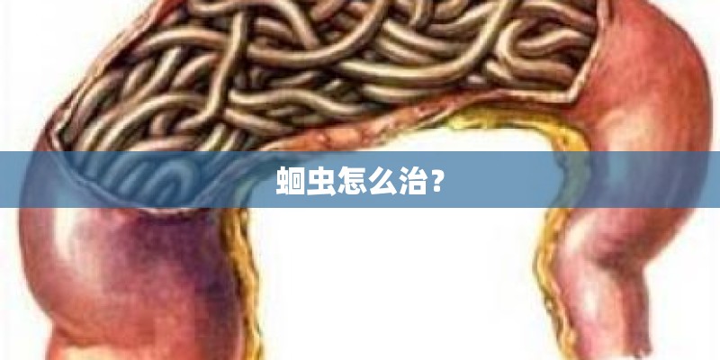 蛔虫怎么治？