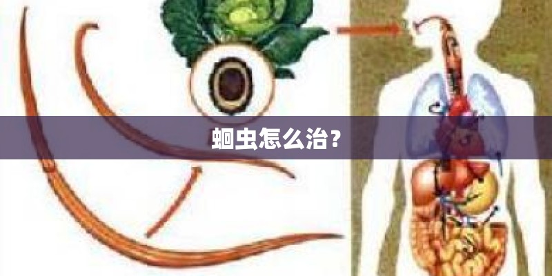 蛔虫怎么治？