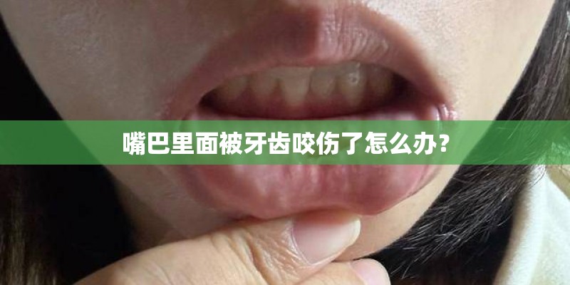 嘴巴里面被牙齿咬伤了怎么办? 嘴巴里面被牙齿咬伤了怎么办?